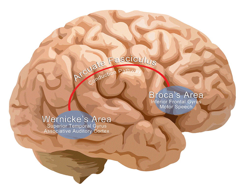 Definition and overview of aphasia, WBR0579 - wikidoc
