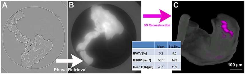 Revealing internal structures, Frontiers | Synchrotron Phase Tomography: An Emerging Imaging Method for Microvessel Detection ...