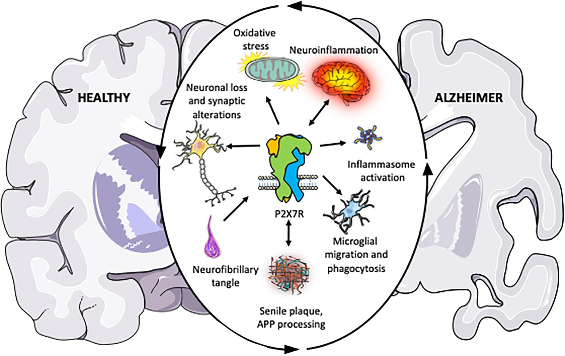 Characteristics and Consequences of Neurodegeneration, Frontiers | The Role of P2X7 Receptor in Alzheimer’s Disease
