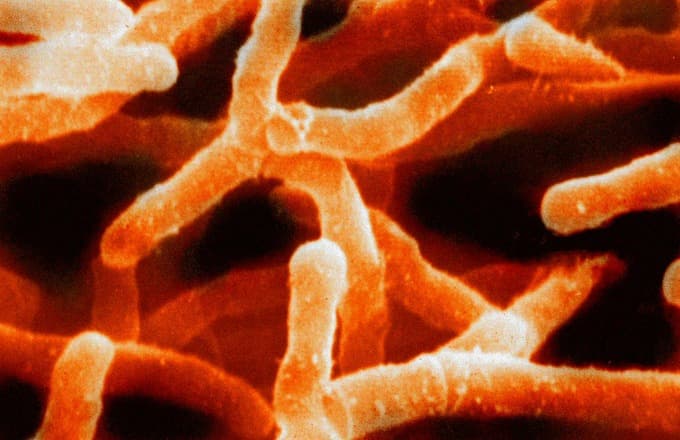 Characteristics of G+C content bacteria, 8.8D: Actinobacteria (High G + C Gram-Positive Bacteria) - Biology LibreTexts