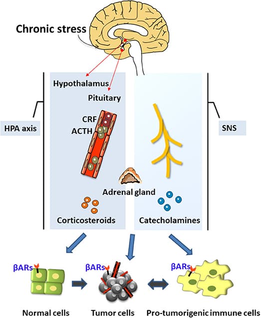Chronic Stress and Immune System, Frontiers | Chronic Stress Promotes Cancer Development