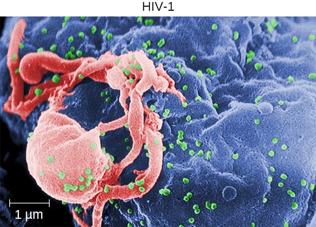 Common circulatory and lymphatic viruses, Viral Infections of the Circulatory and Lymphatic Systems | Microbiology