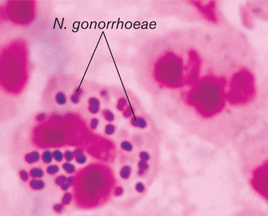 Common reproductive bacterial pathogens, Medical Microbiology