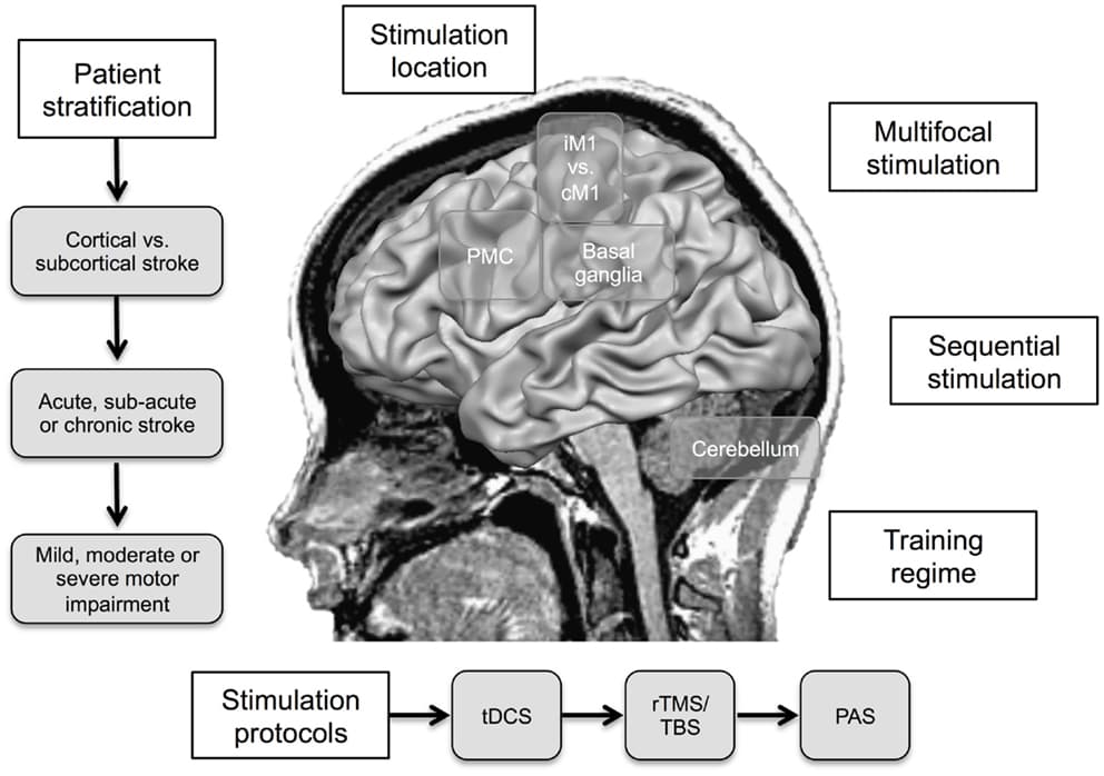 Definition and Types of Neuroenhancement, Frontiers | Non-Invasive Brain Stimulation: An Interventional Tool for Enhancing Behavioral ...