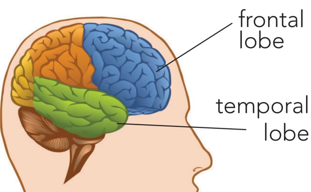 Definition of cognitive disorders, Neurocognitive Disorder Due to Other Neurological Disorders | Abnormal Psychology