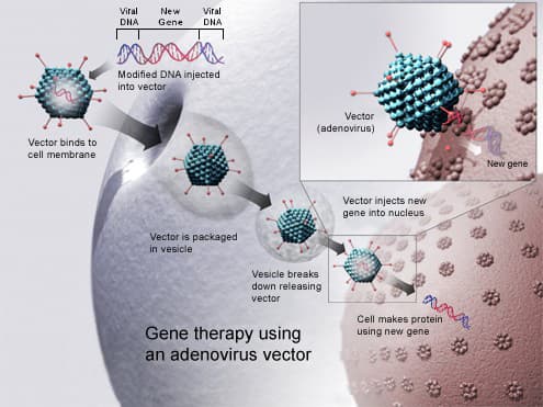 Gene therapy applications, Gene therapy - Wikipedia