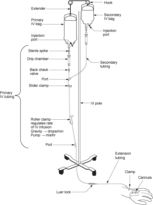 Indications and risks of IV therapy, 8.3 IV Fluids, IV Tubing, and Assessment of an IV System – Clinical Procedures for Safer Patient ...