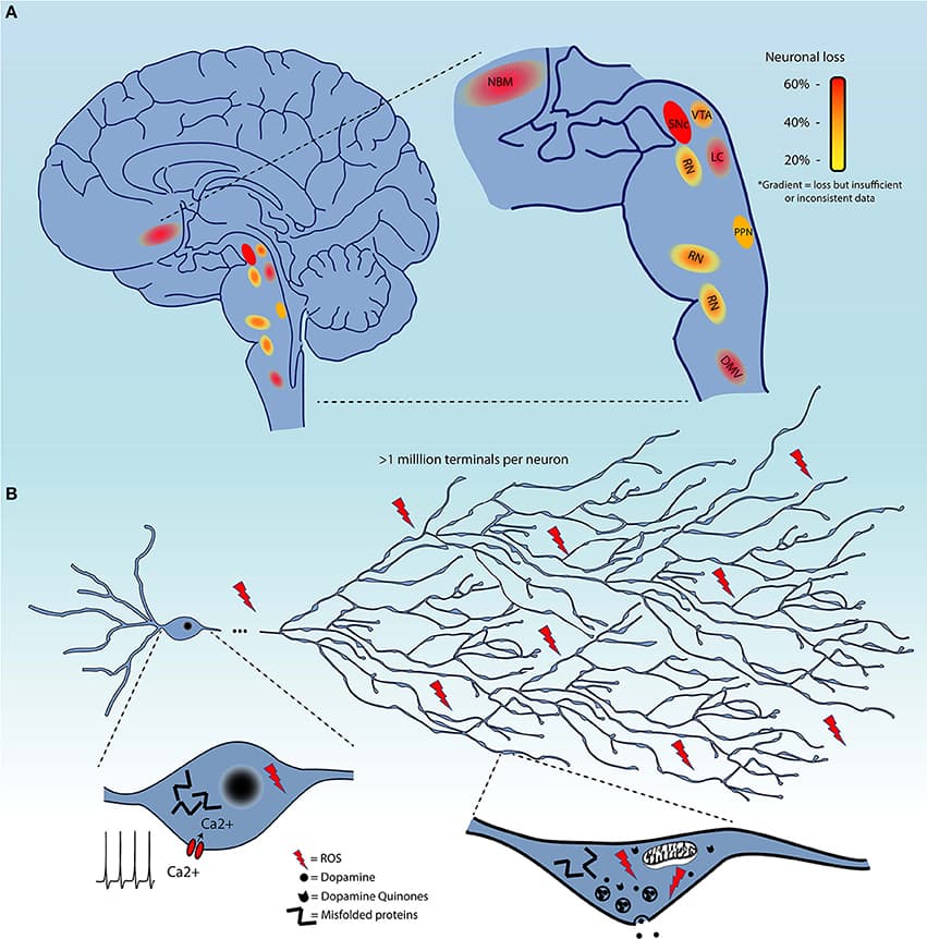 Introduction to Parkinson's Disease, Frontiers | On Cell Loss and Selective Vulnerability of Neuronal Populations in Parkinson's Disease