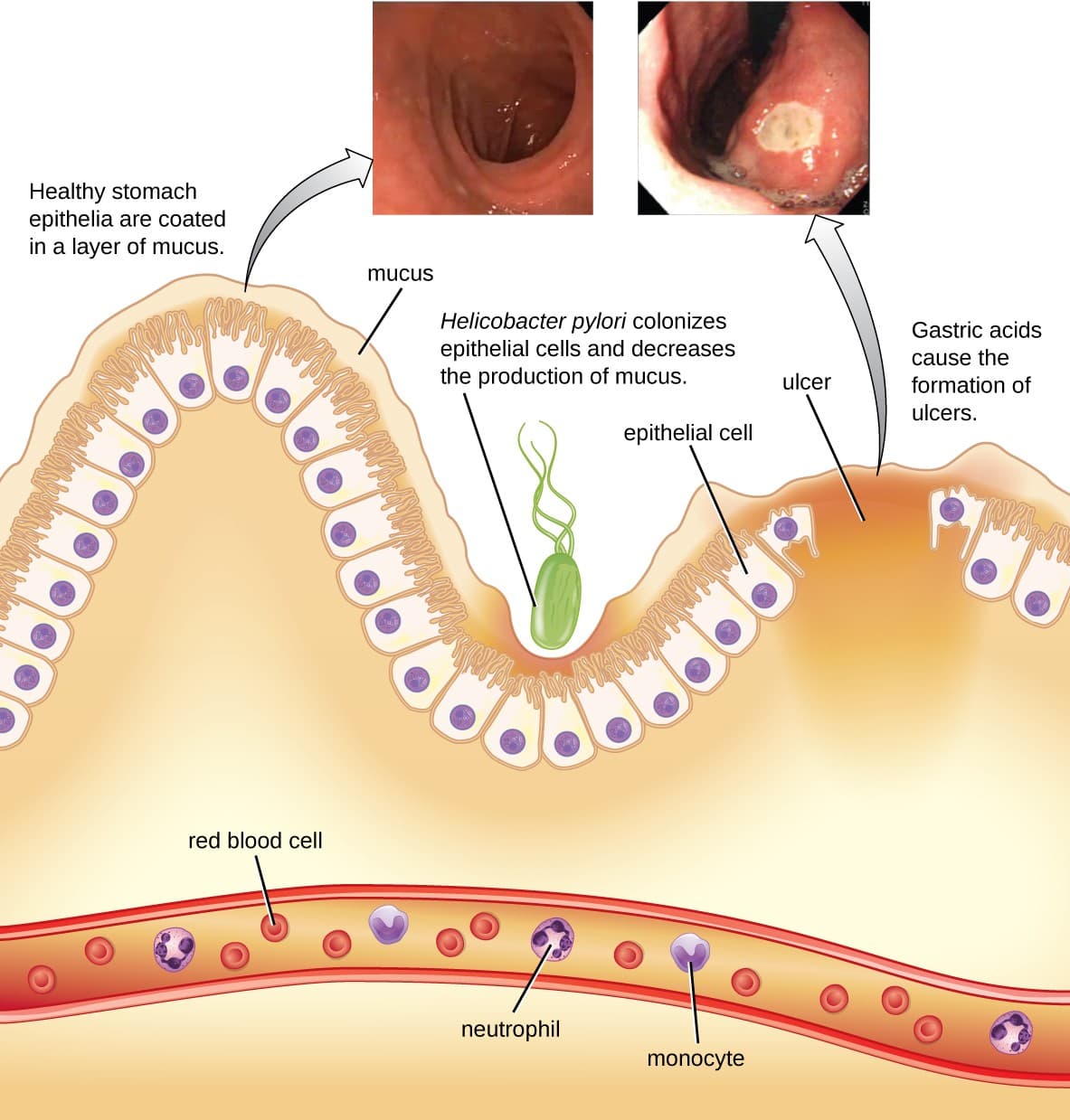 Mechanisms of action, Bacterial Infections of the Gastrointestinal Tract | Microbiology