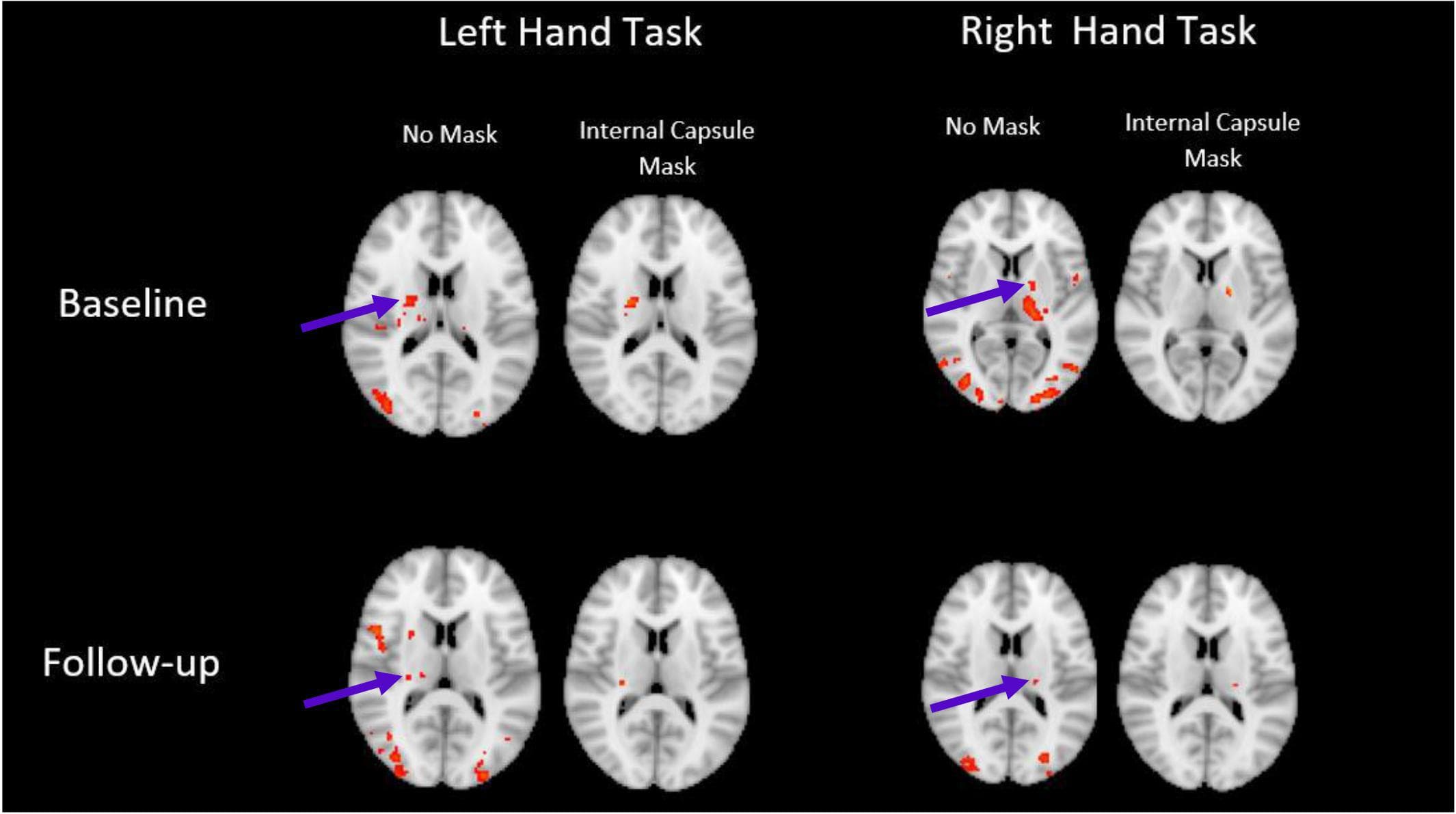 Concept and Relevance to Motor Learning, Frontiers | White Matter Neuroplasticity: Motor Learning Activates the Internal Capsule and ...