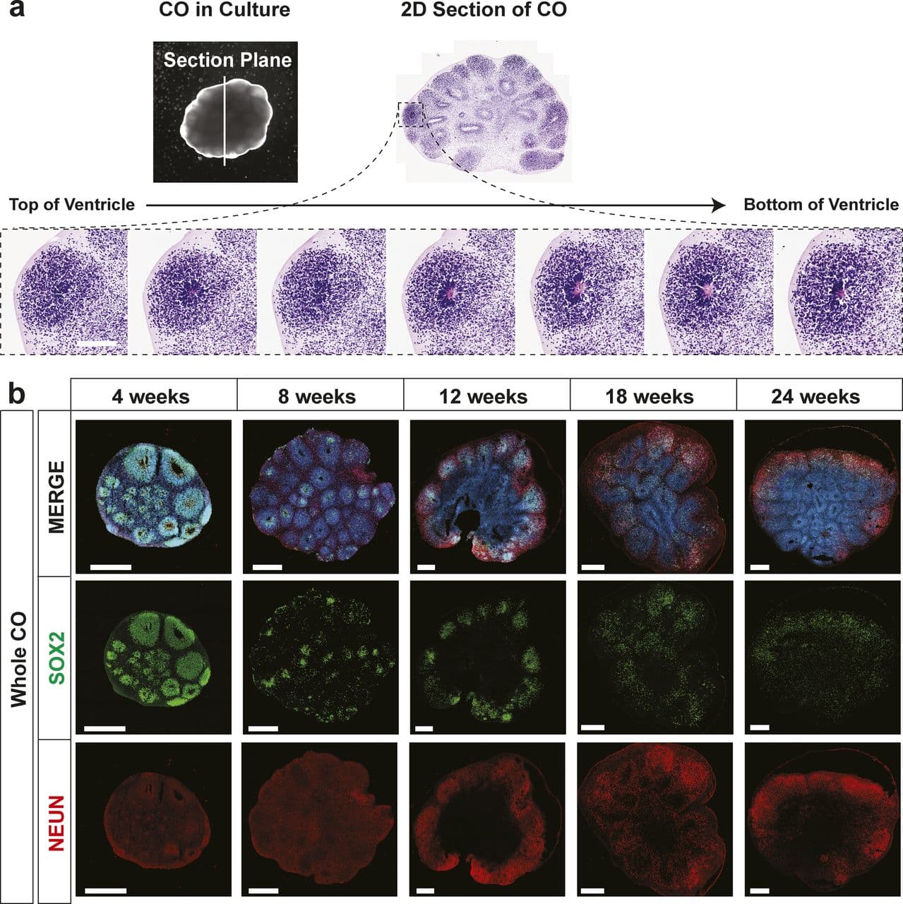 Defining Organoids and Their Formation, Robust production of uniform human cerebral organoids from pluripotent stem cells | Life Science ...