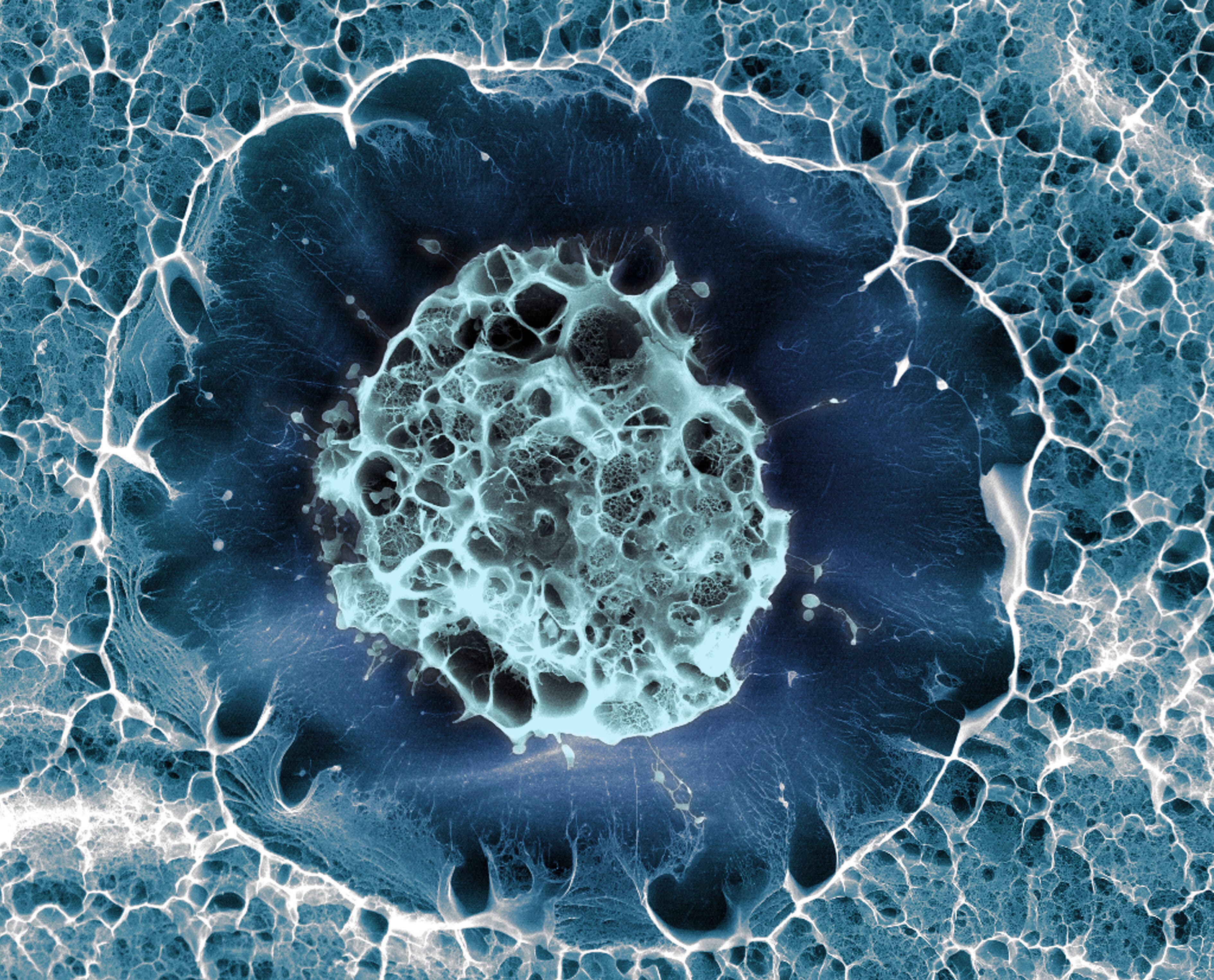 Organoids and stem cell derivation, Human stem cell embedded in a 3D matrix, Cryo SEM. | Wellcome Collection