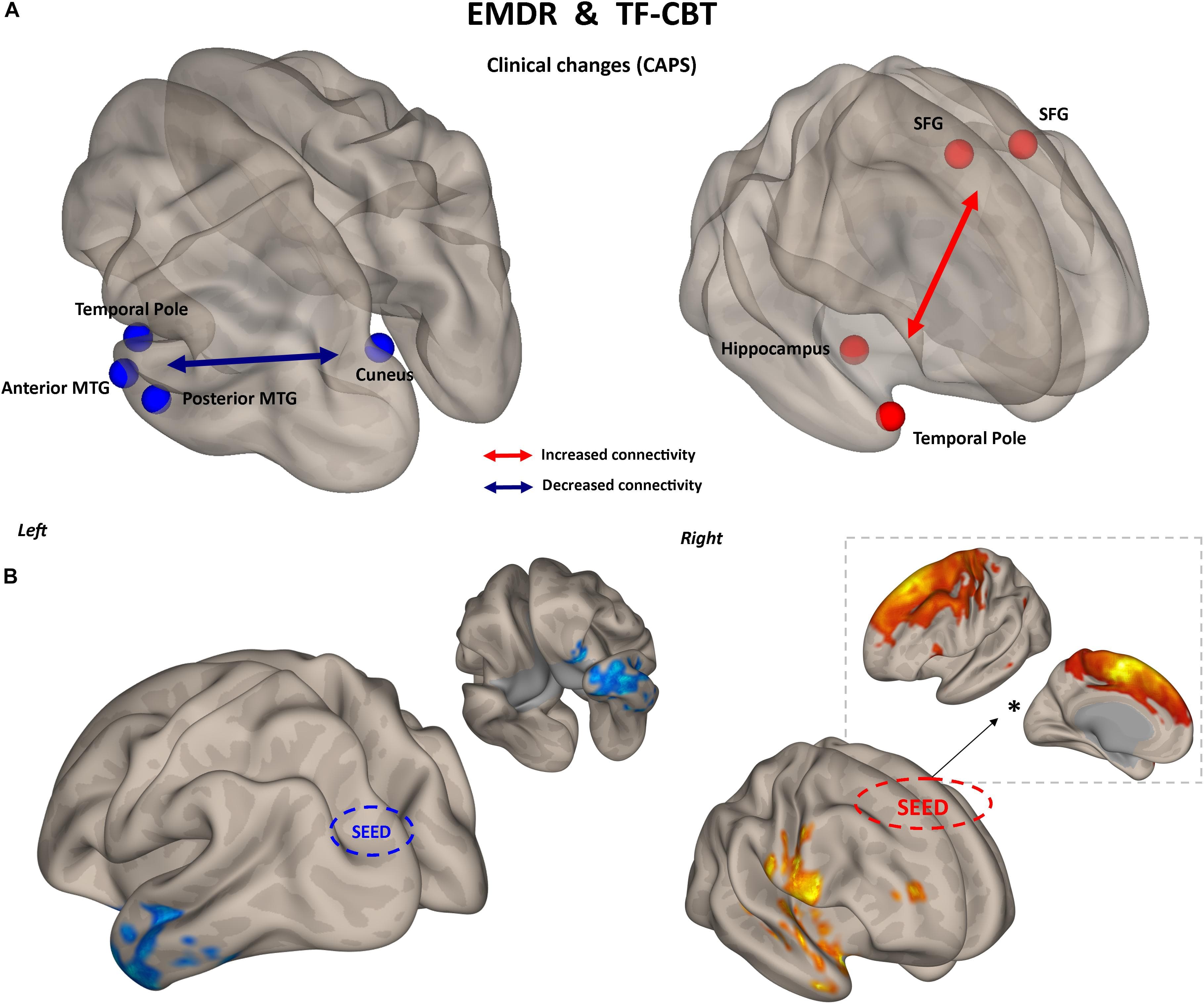 Treatment approaches for PTSD, Frontiers | Psychological and Brain Connectivity Changes Following Trauma-Focused CBT and EMDR ...