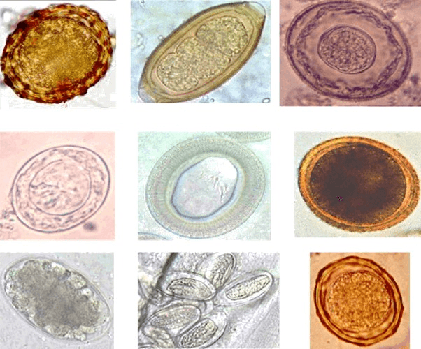 Parasitic worms in microbiology, Helminto - Wikipedia, la enciclopedia libre