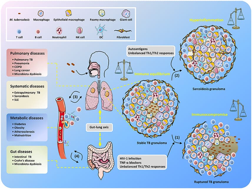 Pathophysiology of tuberculosis, Frontiers | Mycobacterium tuberculosis: An Adaptable Pathogen Associated With Multiple Human ...