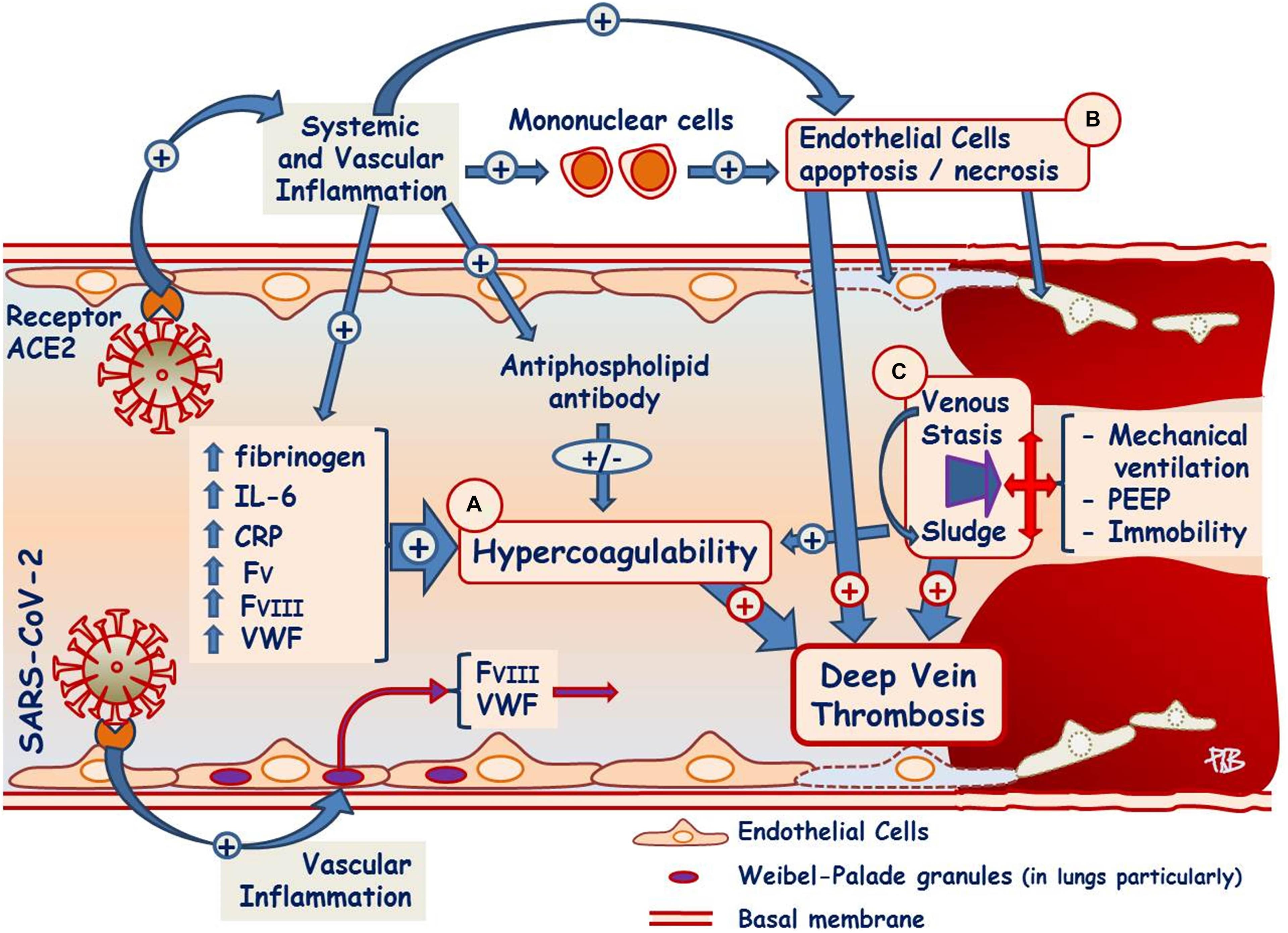 Pathophysiology of vascular diseases, Frontiers | Pathophysiological Processes Underlying the High Prevalence of Deep Vein Thrombosis ...