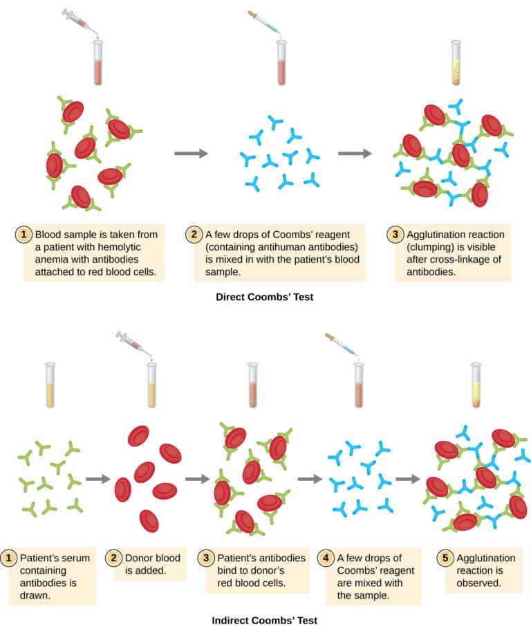 Precipitation vs agglutination assays, Agglutination Assays | Microbiology