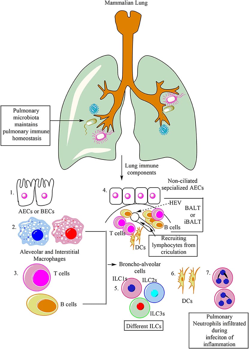 Risk factors and symptoms of pneumonia, Frontiers | Pulmonary Innate Immune Response Determines the Outcome of Inflammation During ...