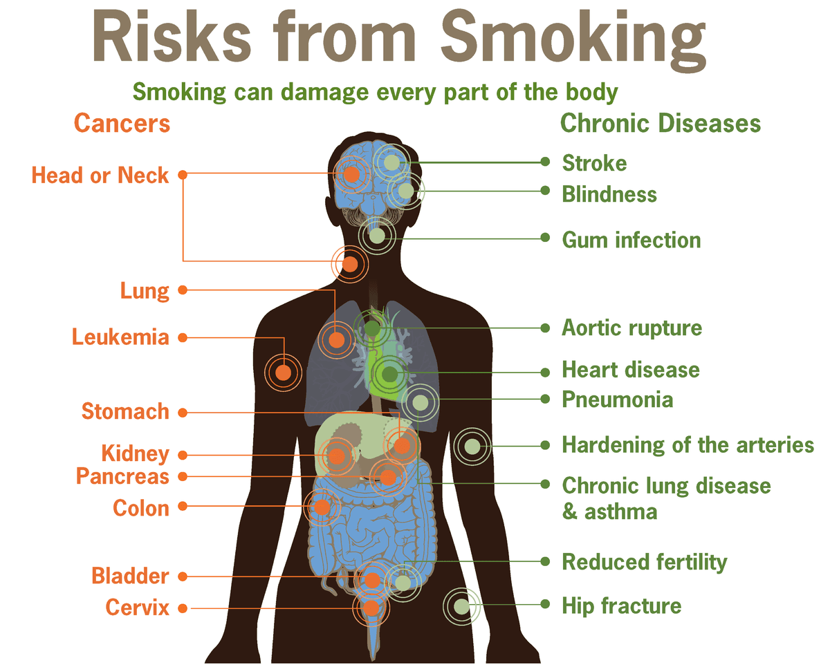 Risk factors for chronic diseases, Health effects of tobacco - Wikipedia