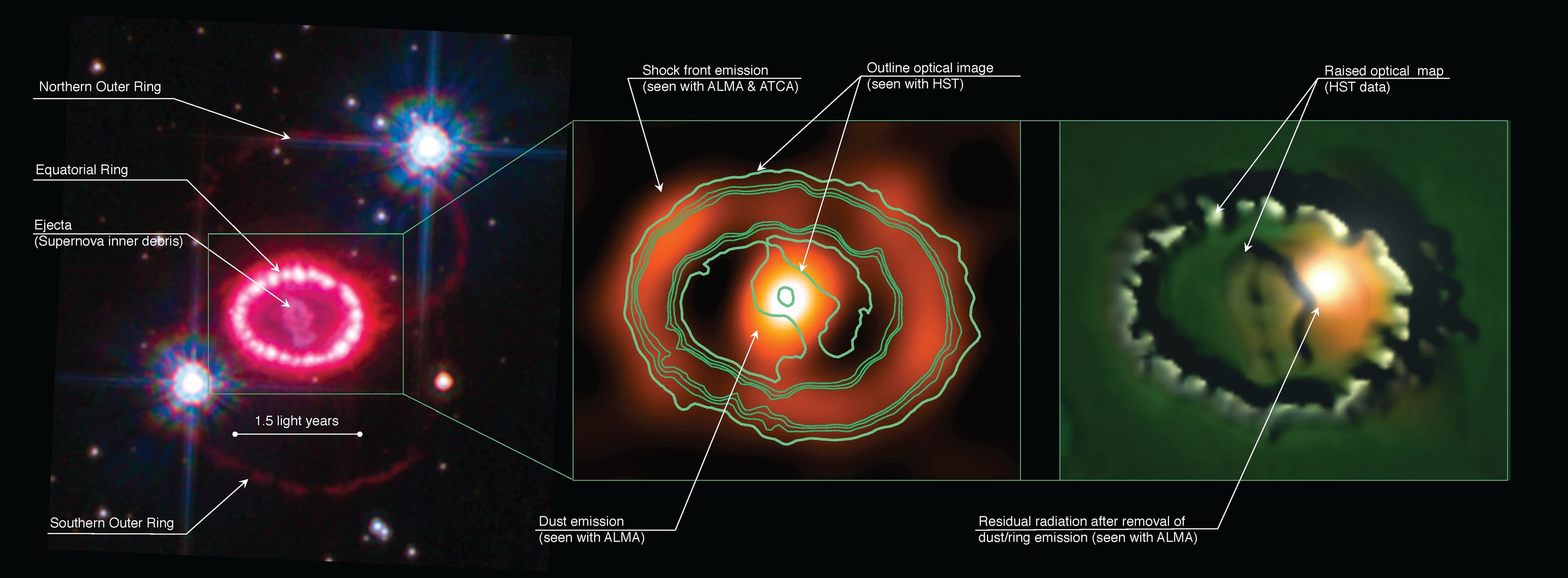 Features of SN 1987A, sn1987a Archives - Universe Today