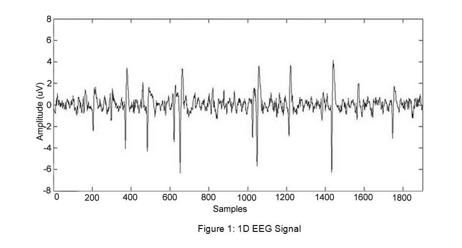 Definition of scalograms, Wavelet Transform for Classification of EEG Signal using SVM and ANN | Biomedical and ...