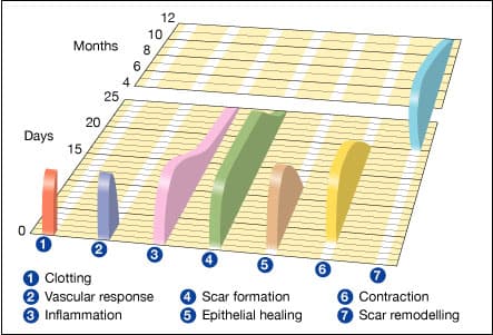 Stages of wound healing, File:Wound healing phases.svg - Wikipedia