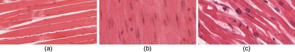 Structural and Functional Characteristics, Types of Muscle Tissues | Anatomy and Physiology I