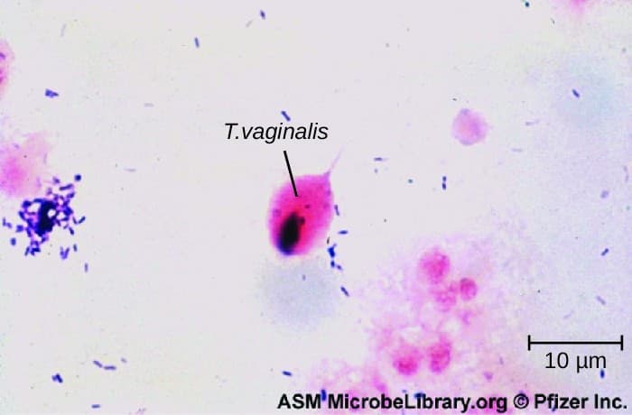 Trichomoniasis pathogenesis and effects, Protozoan Infections of the Urogenital System | Microbiology