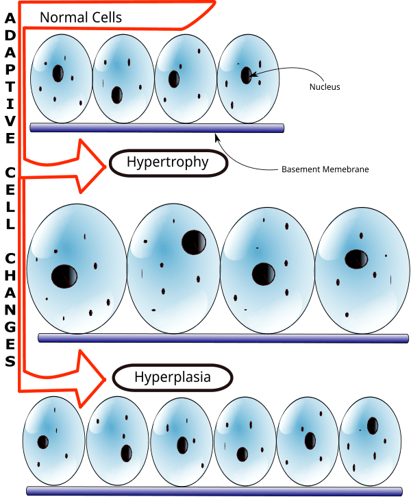Types of cellular adaptations, Hypertrophy - Wikipedia