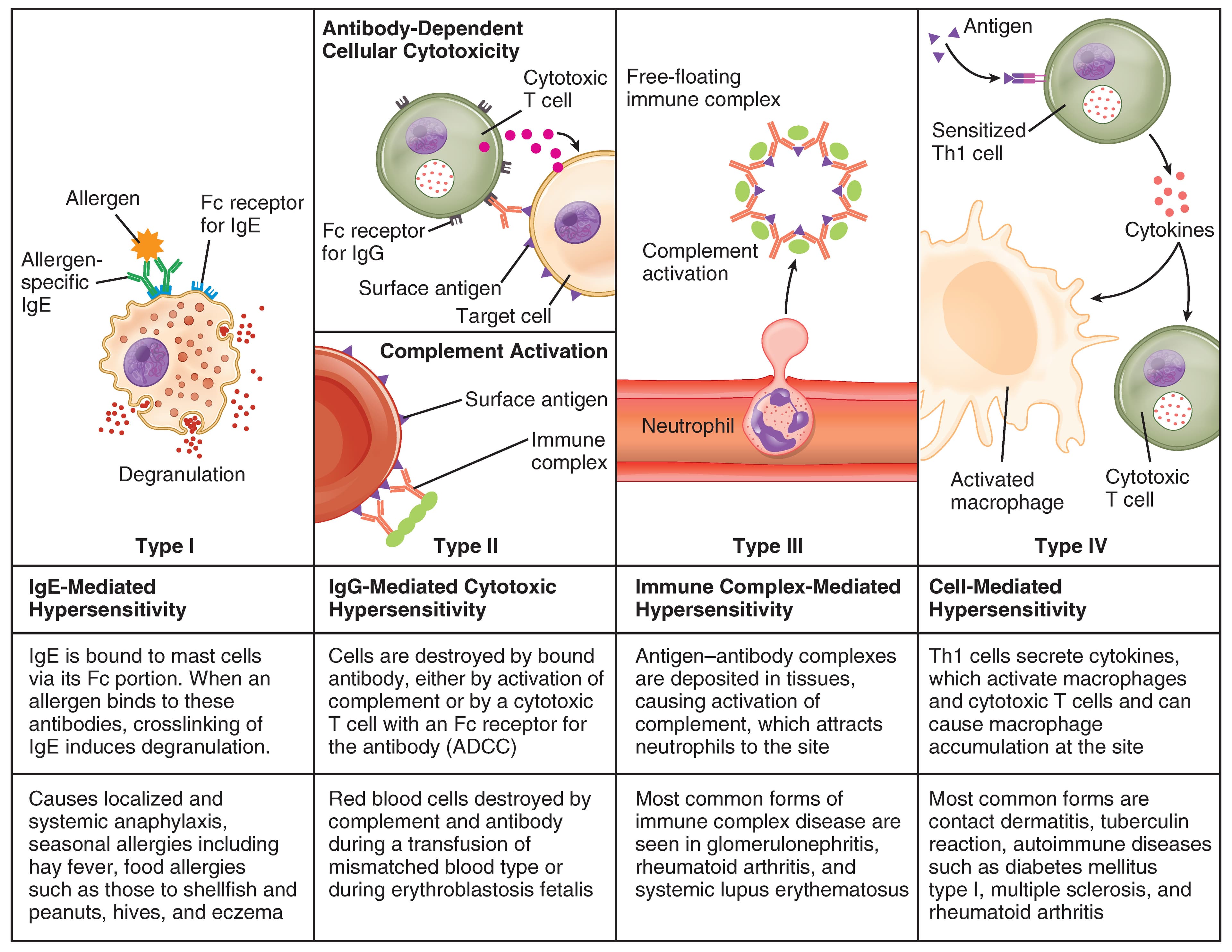 Types of hypersensitivity reactions, Diseases Associated with Depressed or Overactive Immune Responses · Anatomy and Physiology