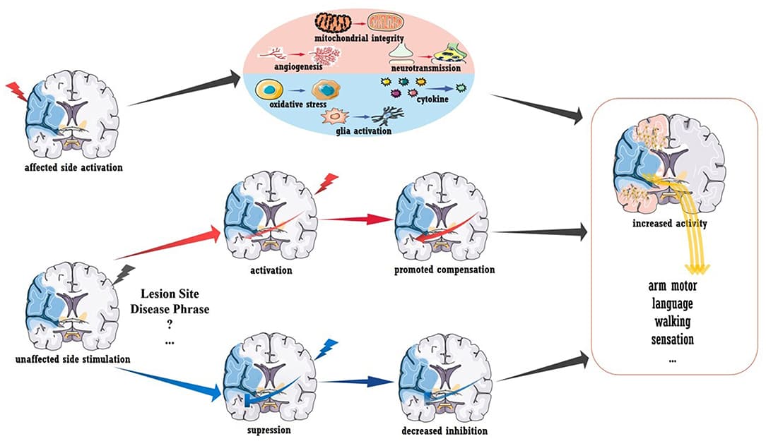 Neural plasticity and its implications for BCI | Brain-Computer ...