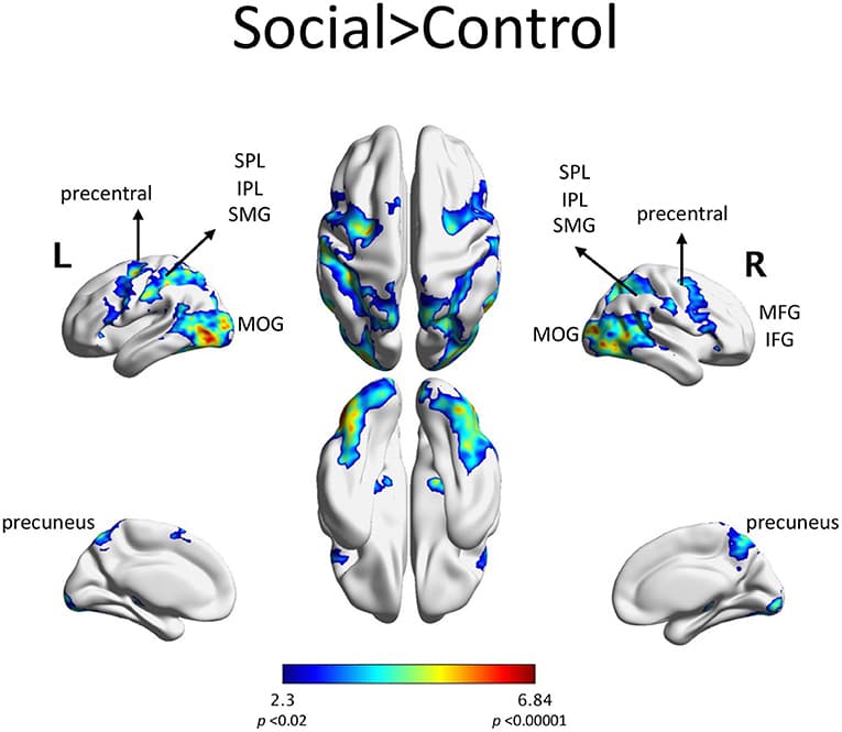 Neuroimaging techniques and their applications | Intro to Cognitive ...